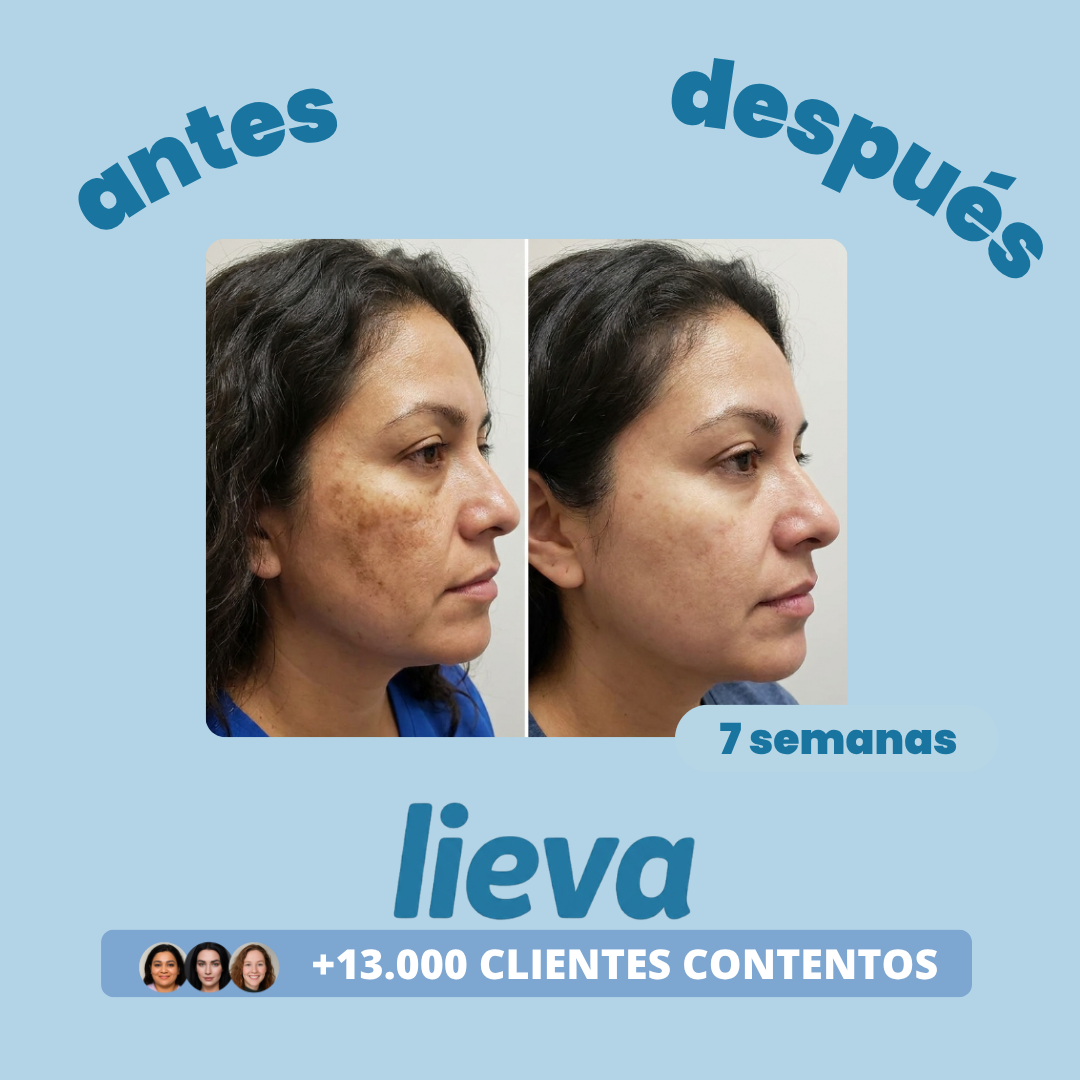 Lieva™ | Tratamiento para Manchas Oscuras